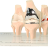 Knee Pathology Demonstration Models