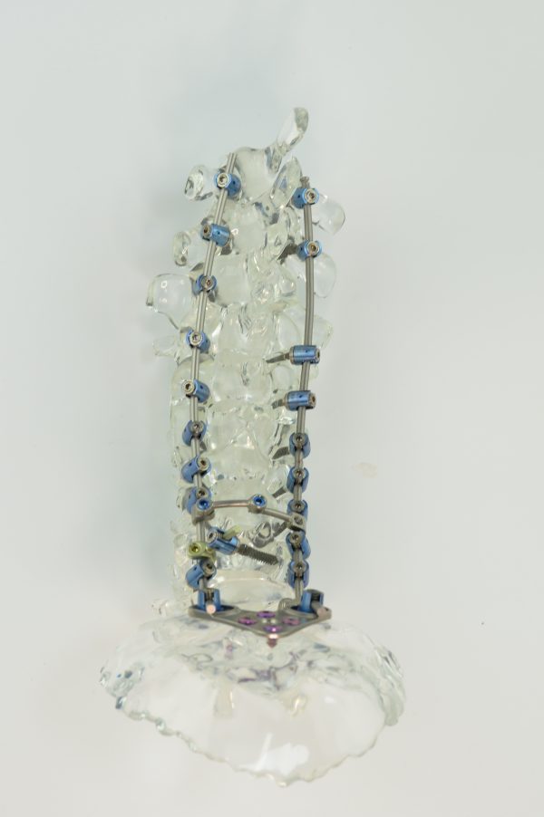 spine models