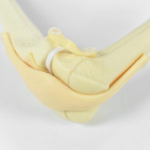 Knees training models