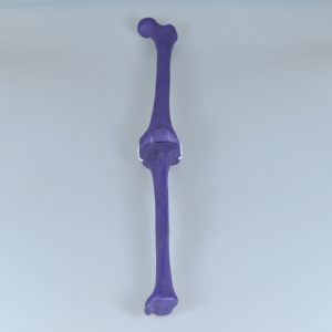 CT scan & X-Ray models of femur and tibial