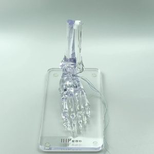 fibula & foot