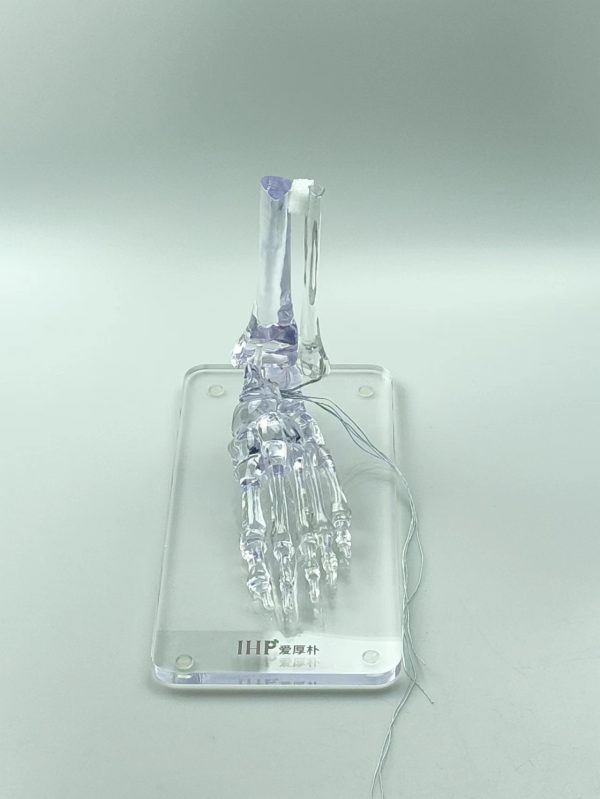 fibula & foot
