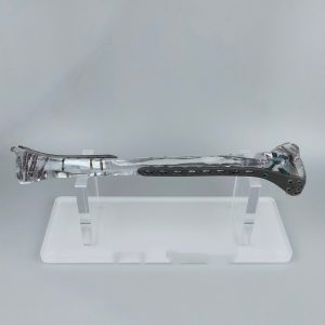 trauma tibia Clear bones