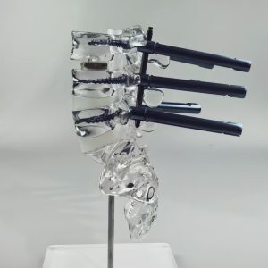 L1-L5+sacrum clear bones